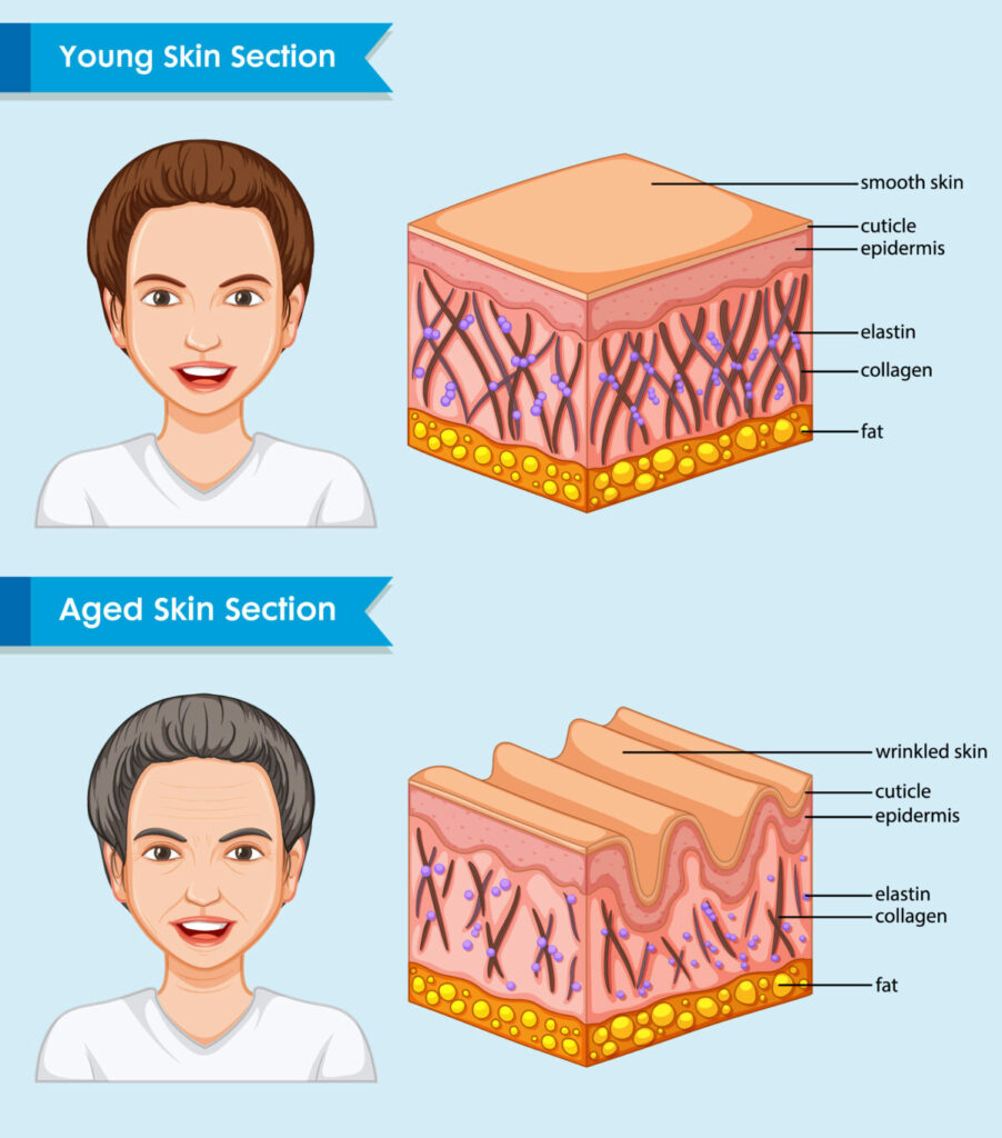 envejecimiento piel