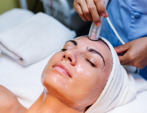 Everything You Should Know About Chemical Peels