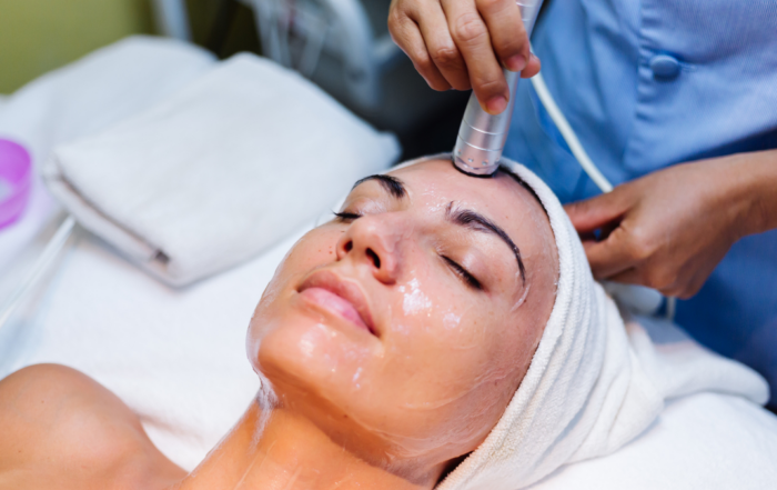 everything about chemical peels
