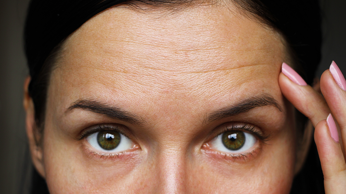 Closeup of a woman with forehead wrinkles